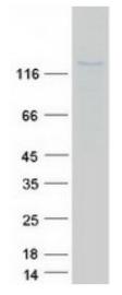 SDS-PAGE (NOS2-986HFL).jpg